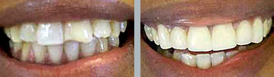 philadelphia cosmetic dentist image