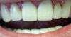 philadelphia cosmetic dentist image