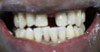 philadelphia cosmetic dentist image