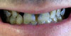 philadelphia cosmetic dentist image