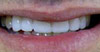 philadelphia cosmetic dentist image