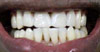 philadelphia cosmetic dentist image