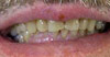 philadelphia cosmetic dentist image