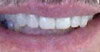 philadelphia cosmetic dentist image