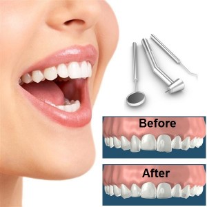 Dental-Reshaping