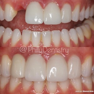 cosmetic dentistry